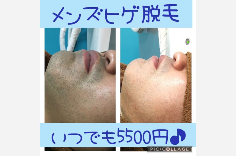 D8230F87-7C4B-474D-9E75-81ADF7DDC17A
